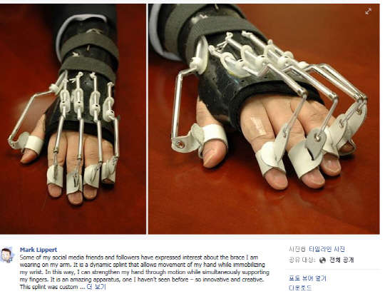 리퍼트 대사, 팔 치료 보조장치 소개   마크 리퍼트 주한미국대사가 3일 자신의 페이스북 계정에 피습 이후 치료를 위해 착용한 팔 치료 보조장치에 대한 사진과 설명을 올렸다. 리퍼트 대사는 &quot;매우 편안하고 회복 과정에 큰 차이를 만들어 줬다&quot;며 &quot;손으로 물건을 집을 수도 있다&quot;고 전했다.